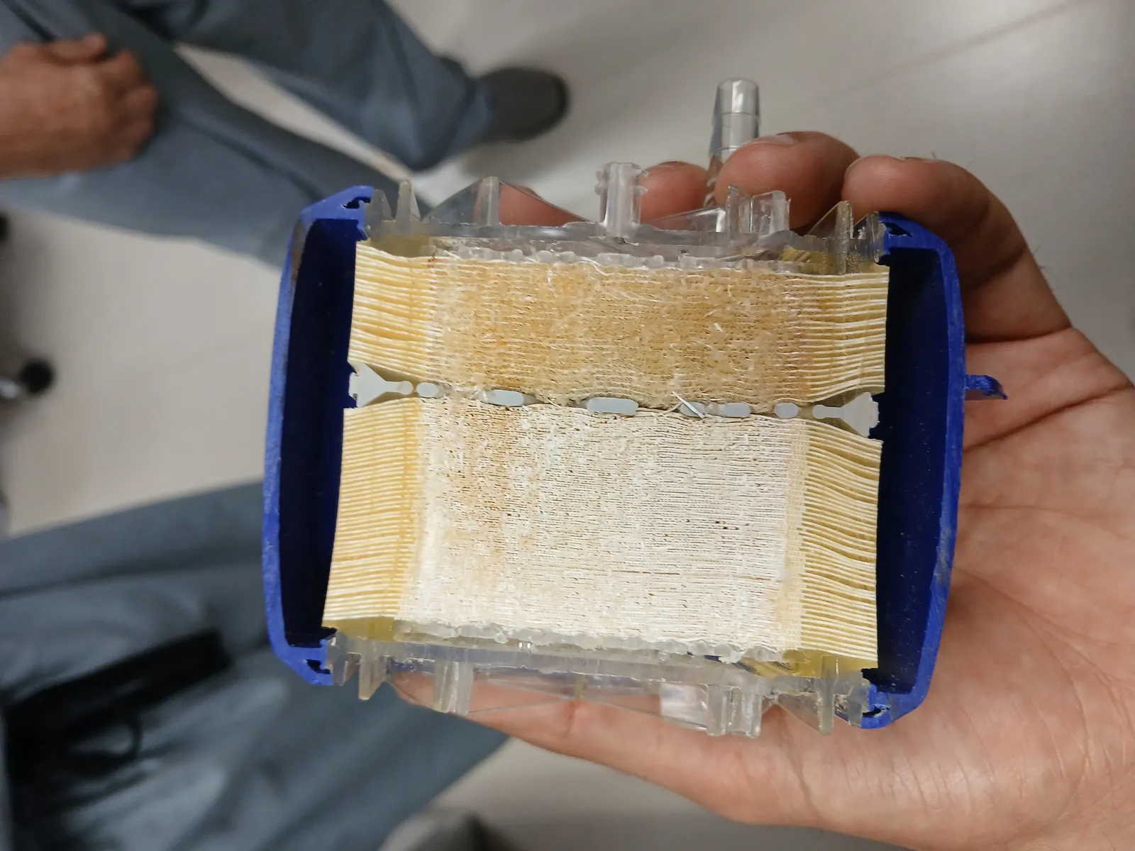 A conventional hollow-fiber oxygenator cut open in a hand, showing bundled fibers inside a blue housing.